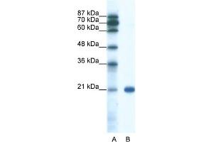 WB Suggested Anti-SSX2 Antibody Titration:  0. (SSX2 anticorps  (C-Term))