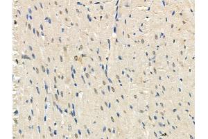 Phospho-TORC2 (Ser275) Antibody at 1/100 staining Rat heart tissue by IHC-P. (CRTC2 anticorps  (pSer275))