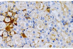 Immunohistochemistry of paraffin-embedded Rat kidney using TFF1 Polyclonal Antibody at dilution of 1:200 (40x lens). (TFF1 anticorps)