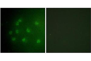 Immunofluorescence analysis of COS7 cells, using Retinoblastoma (Phospho-Thr826) antibody.