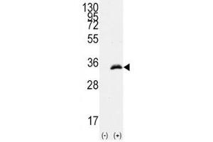 Western blot analysis of CDC2 antibody and 293 cell lysate (2 ug/lane) either nontransfected (Lane 1) or transiently transfected with the human gene (2).