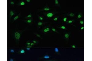 Immunofluorescence analysis of U-2 OS cells using MDC1 Polyclonal Antibody at dilution of 1:100. (MDC1 anticorps)