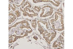 IHC analysis of LPP using anti-LPP antibody (ABIN7599606).
