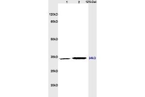 Lane 1: rat brain lysates Lane 2: rat heart lysates probed with Anti CD1A Polyclonal Antibody, Unconjugated (ABIN702700) at 1:200 in 4 °C.