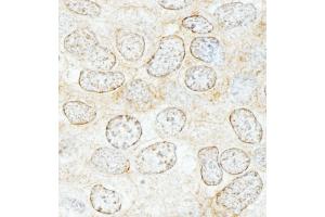 Immunohistochemistry (IHC) image for anti-Nucleoporin 50kDa (NUP50) (AA 225-275) antibody (ABIN7454784)