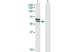 Western Blot analysis of STS expression in transfected 293T cell line by STS MaxPab polyclonal antibody. (STS anticorps  (AA 1-583))