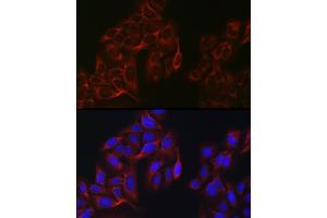 Immunofluorescence analysis of U2OS cells using eIF4 Rabbit pAb (ABIN6129659, ABIN6140076, ABIN6140077 and ABIN6220909) at dilution of 1:100 (40x lens). (EIF4A1 anticorps  (AA 1-406))