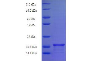 SDS-PAGE (SDS) image for Basic Leucine Zipper Transcriptional Factor ATF-Like 3 (BATF3) (AA 1-133), (full length) protein (His tag) (ABIN5709115)