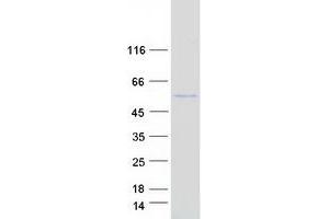 Validation with Western Blot