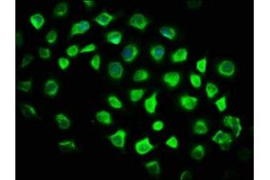 Immunofluorescence staining of A549 cells with ABIN7176582 at 1:116, counter-stained with DAPI.
