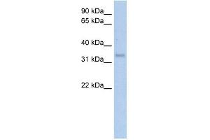 WB Suggested Anti-CA4 Antibody Titration:  5. (CA4 anticorps  (Middle Region))