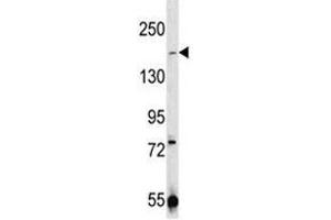 TRPM7 antibody western blot analysis in 293 lysate