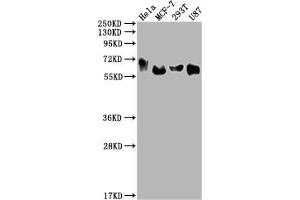 Western Blot Positive WB detected in: Hela whole cell lysate, MCF-7 whole cell lysate, 293T whole cell lysate, U87 whole cell lysate All lanes: GBA antibody at 1:2000 Secondary Goat polyclonal to rabbit IgG at 1/50000 dilution Predicted band size: 60, 58, 55, 51, 30 kDa Observed band size: 60 kDa (Recombinant GBA anticorps)