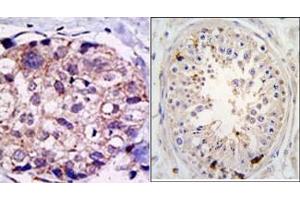 Image no. 1 for anti-Ubiquitin Specific Peptidase 2 (USP2) (C-Term) antibody (ABIN357521) (USP2 anticorps  (C-Term))