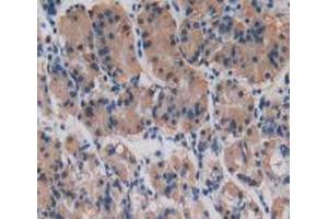 IHC-P analysis of Human Stomach Tissue, with DAB staining. (Procollagen Type I Propeptide anticorps  (N-Term))