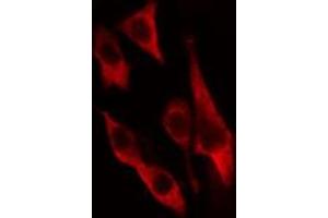 ABIN6274653 staining HeLa cells by IF/ICC. (CYP2U1 anticorps  (Internal Region))