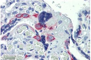 Placenta, Human: Formalin-Fixed, Paraffin-Embedded (FFPE) (ZNF71 anticorps  (C-Term))