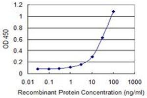 Detection limit for recombinant GST tagged TK1 is 0. (TK1 anticorps  (AA 1-234))