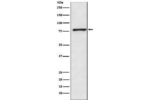 Western blot analysis of Fructose 6 Phosphate Kinase expression in HeLa cell lysate.