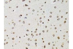Immunohistochemistry of paraffin-embedded rat brain using TMPO Antibody (ABIN1875122) at dilution of 1:100 (40x lens). (Thymopoietin anticorps)