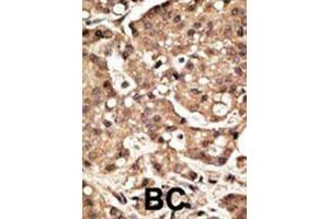 anti-Autophagy related 4C Cysteine Peptidase (ATG4C) (AA 419-448), (C-Term) antibody