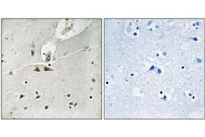 Immunohistochemical analysis of paraffin-embedded human brain tissue using Ephrin B1/B2/B3 (Phospho-Tyr324) antibody (left)or the same antibody preincubated with blocking peptide (right). (EFNB1/EFNB2/EFNB3 (pTyr324) anticorps)