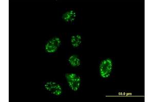 Immunofluorescence of purified MaxPab antibody to SH2D3A on HeLa cell.