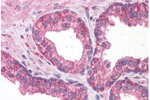 Human Prostate: Formalin-Fixed, Paraffin-Embedded (FFPE)