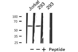Western blot analysis of extracts from Jurkat/293 cells, using ZNF695 antibody. (ZNF695 anticorps  (C-Term))