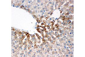 Anti-Flavin containing monooxygenase 4 antibody, IHC(P) IHC(P): Rat Liver Tissue (FMO4 anticorps  (N-Term))