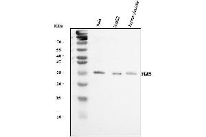 Western blot analysis of SNAP23 using anti-SNAP23 antibody (ABIN7603236). (SNAP23 anticorps  (N-Term))