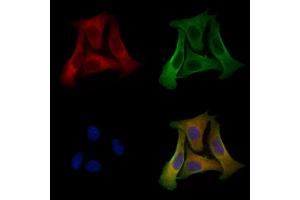 ABIN6256878 and ABIN6274572 staining Hela cells by IF/ICC. (Serotonin Receptor 2B anticorps  (Internal Region))