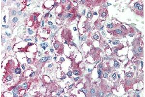 Human Adrenal (formalin-fixed, paraffin-embedded) stained with CARD9 antibody ABIN214431 at 10 ug/ml followed by biotinylated goat anti-rabbit IgG secondary antibody ABIN481713, alkaline phosphatase-streptavidin and chromogen.