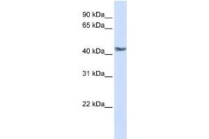 WB Suggested Anti-PDK3 Antibody Titration:  0. (PDK3 anticorps  (N-Term))