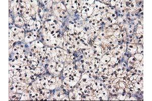 Image no. 1 for anti-Destrin (Actin Depolymerizing Factor) (DSTN) antibody (ABIN1497907)