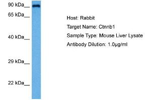 Host:  Rabbit  Target Name:  CTNNB1  Sample Tissue:  Mouse Liver  Antibody Dilution:  1ug/ml (CTNNB1 anticorps  (C-Term))