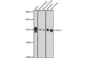 Western blot analysis of extracts of various cell lines, using SRSF7 Rabbit pAb (ABIN7270548) at 1:1000 dilution. (SFRS7 anticorps  (AA 60-120))