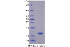 Image no. 1 for CD7 (CD7) (AA 23-128) protein (T7 tag,His tag) (ABIN6238891)