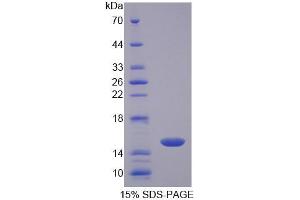 Image no. 1 for CD7 (CD7) (AA 23-128) protein (T7 tag,His tag) (ABIN6238891) (CD7 Protein (CD7) (AA 23-128) (T7 tag,His tag))
