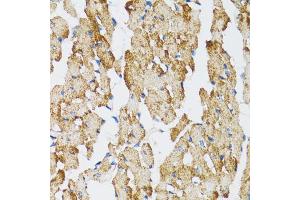 Immunohistochemistry of paraffin-embedded mouse heart using CASP3 antibody (ABIN4903140) at dilution of 1:100 (40x lens). (Caspase 3 anticorps)