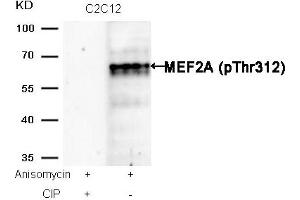 Western blot analysis of extracts from C2C12 cells, treated with Anisomycin or calf intestinal phosphatase (CIP), using MEF2A (Phospho-Thr312) Antibody. (MEF2A anticorps  (pThr312))