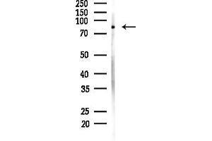 anti-MAD1 Mitotic Arrest Deficient-Like 1 (MAD1L1) (N-Term) antibody