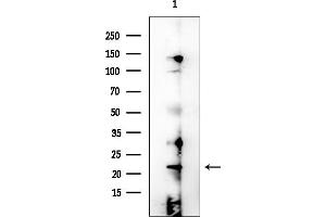 anti-Prostate and Breast Cancer Overexpressed Protein 1 (PBOV1) (Internal Region) antibody