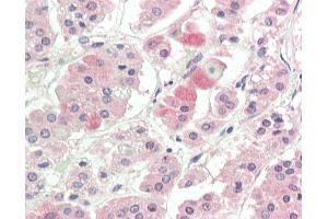 Human, Adrenal: Formalin-Fixed Paraffin-Embedded (FFPE).