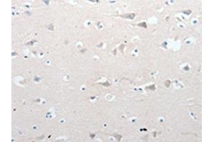 The image on the left is immunohistochemistry of paraffin-embedded Human brain tissue using ABIN7190766(GCH1 Antibody) at dilution 1/15, on the right is treated with synthetic peptide.