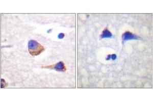 Immunohistochemistry analysis of paraffin-embedded human brain, using JAK3 (Phospho-Tyr785) Antibody. (JAK3 anticorps  (pTyr785))