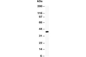 Western blot testing of Caveolin-1 antibody and recombinant human protein (0.