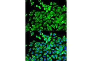 Immunofluorescence analysis of MCF-7 cells using EIF4A1 antibody. (EIF4A1 anticorps)