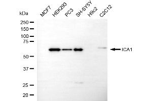 anti-Islet Cell Autoantigen 1, 69kDa (ICA1) antibody