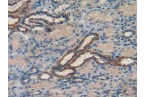 Figure. (RBP1 anticorps  (AA 2-135))